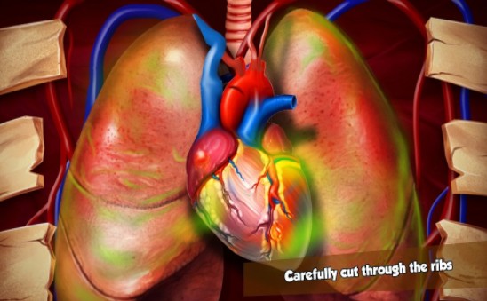 心脏问题游戏安卓手机版（Heart Surgery）图1:
