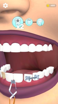 假牙医生游戏最新安卓版图3: